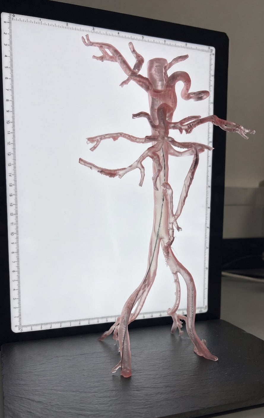 Abdominal Pelvic Angiolab